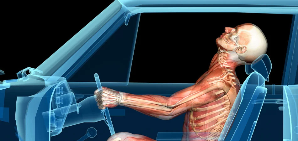 Lafayette Rear-End Collision Lawyer-image